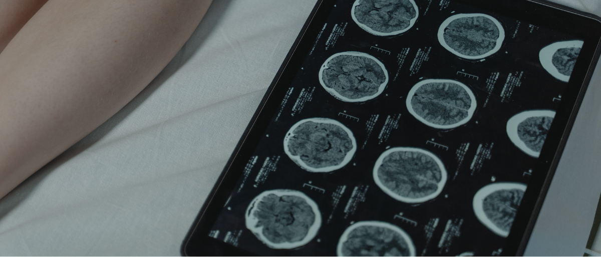 neurology1200x515 neurology1200x515