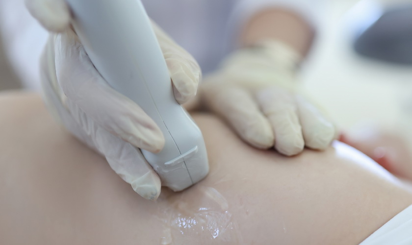 doctor-doing-ultrasound-examination-woman-breast-closeup