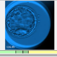 Embryoscope_240x240