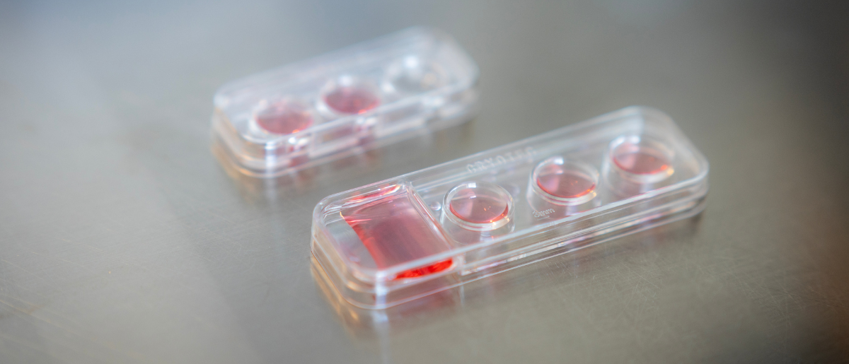 специализирани изследвания 1200 515 заглавна