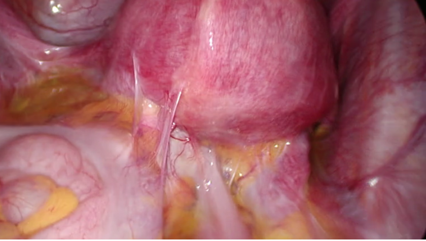 Video_EndoPatho_840x476